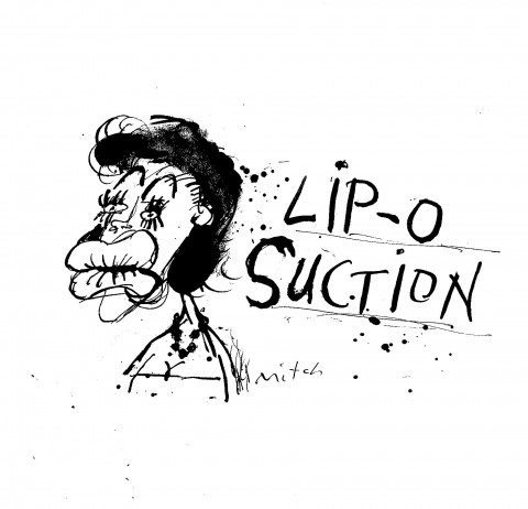 Lip-O-Suction